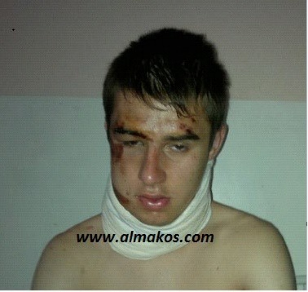 Момче брутално претепано во Лисиче image